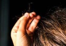 Know About Trichotillomania!