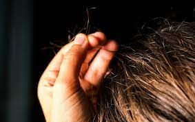 Know About Trichotillomania!